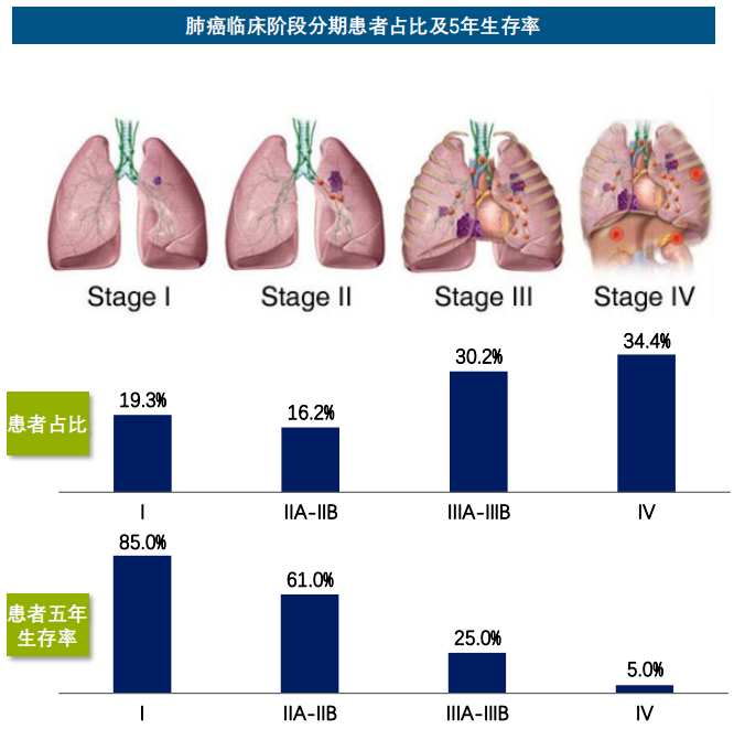 肺癌最新状况，研究、治疗与预防的新进展